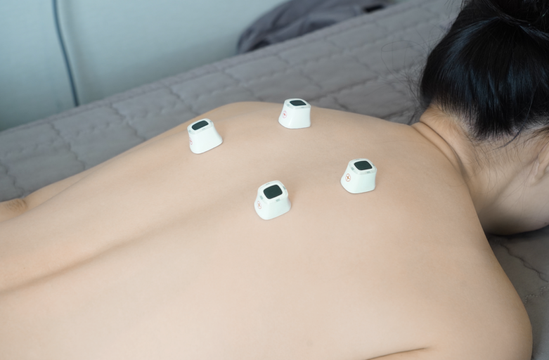 cupping